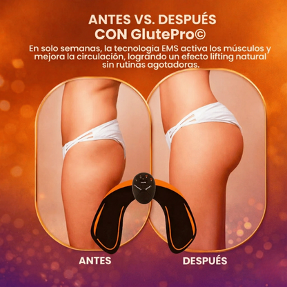 GlutePro© - Estimulador de Glúteos